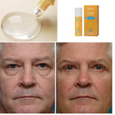 Rolon 4 em 1 Ultra Rejuvenescedor Luteína LumeEyes | Reduz bolsas e ilumina o olhar rapidamente