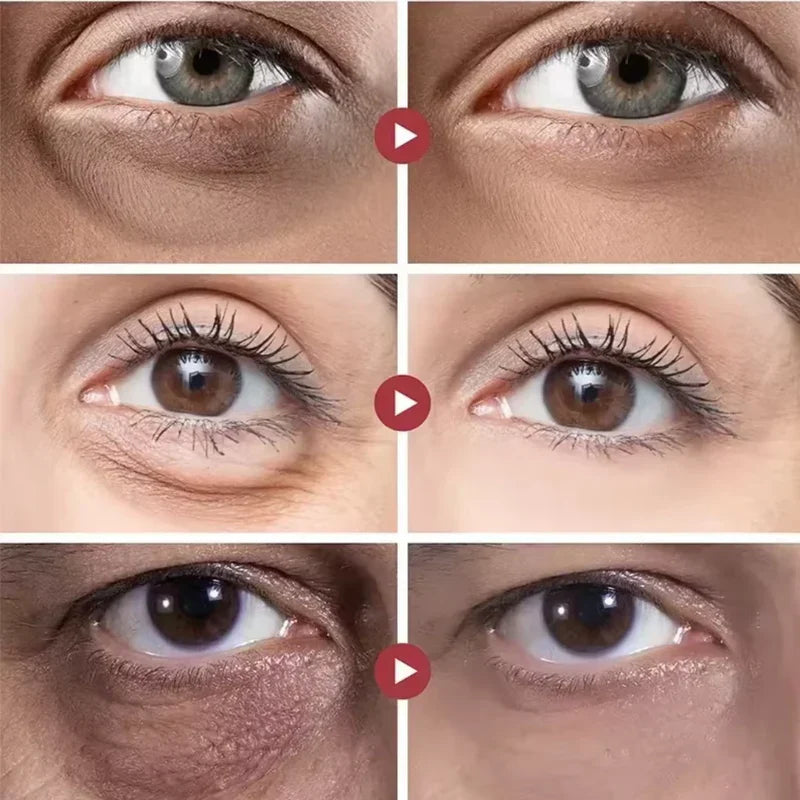 Rolon 4 em 1 Ultra Rejuvenescedor Luteína LumeEyes | Reduz bolsas e ilumina o olhar rapidamente